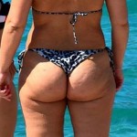 Petit cul et cellulite. תמונה מהתחת